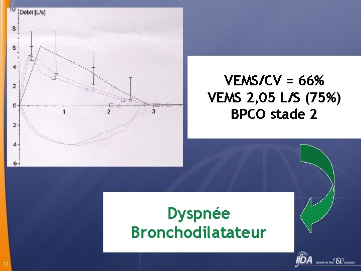 VEMS/CV = 66% VEMS 2, 05 L/S (75%) BPCO stade 2 Dyspnée Bronchodilatateur 12