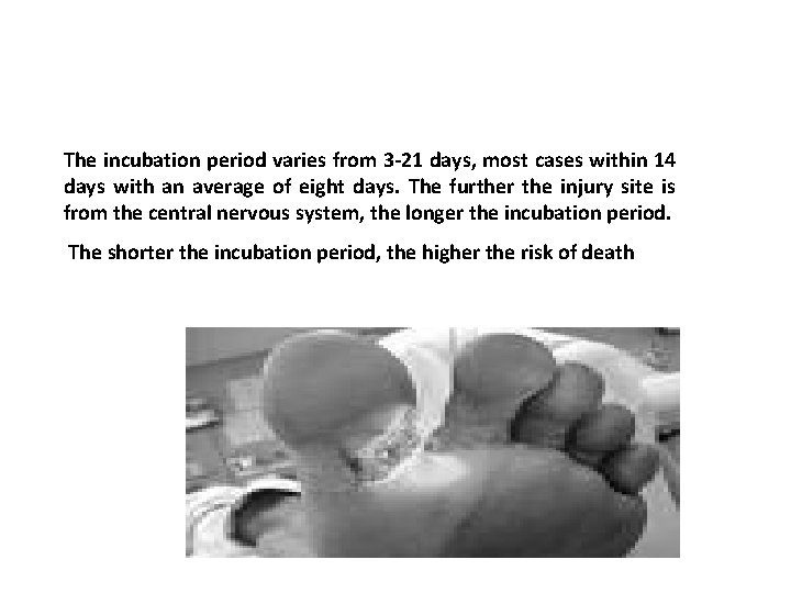 The incubation period varies from 3 -21 days, most cases within 14 days with