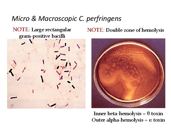 Micro & Macroscopic C. perfringens NOTE: Large rectangular gram-positive bacilli NOTE: Double zone of