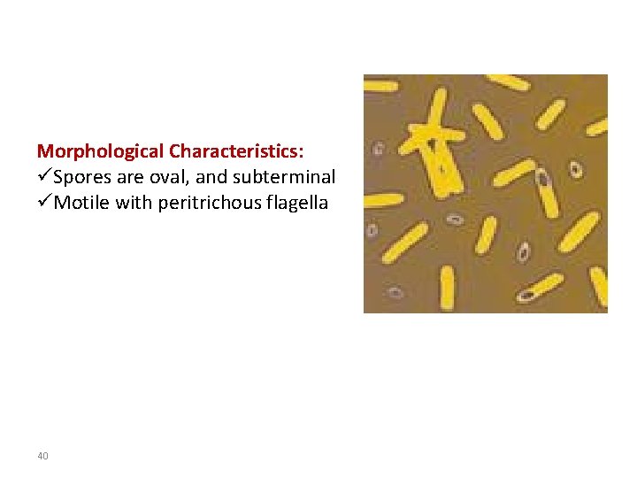 Morphological Characteristics: üSpores are oval, and subterminal üMotile with peritrichous flagella 40 