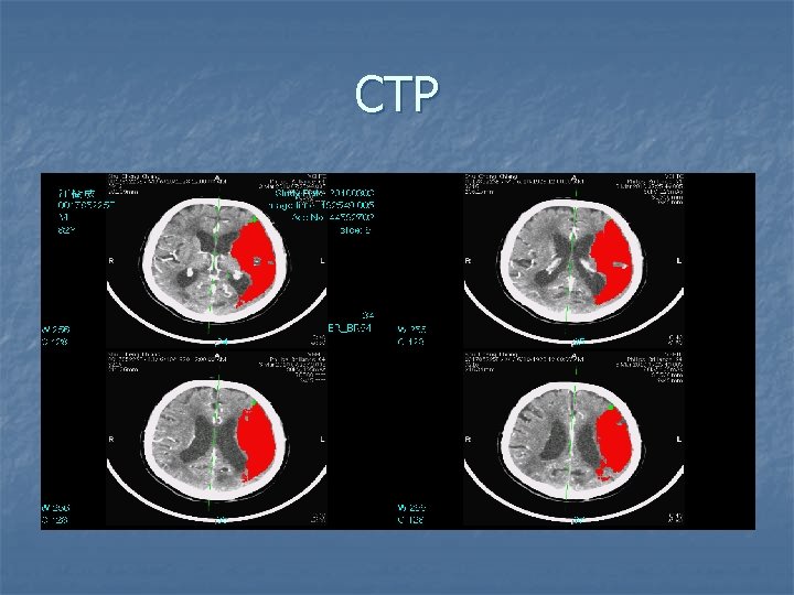 CTP 