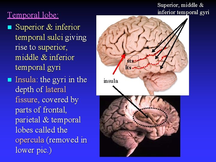 Temporal lobe: n Superior & inferior temporal sulci giving rise to superior, middle &