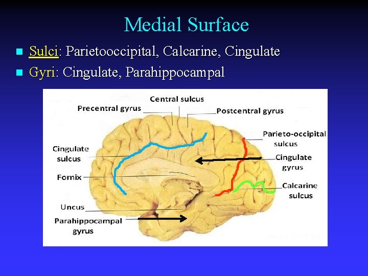 Medial Surface n n Sulci: Parietooccipital, Calcarine, Cingulate Gyri: Cingulate, Parahippocampal 