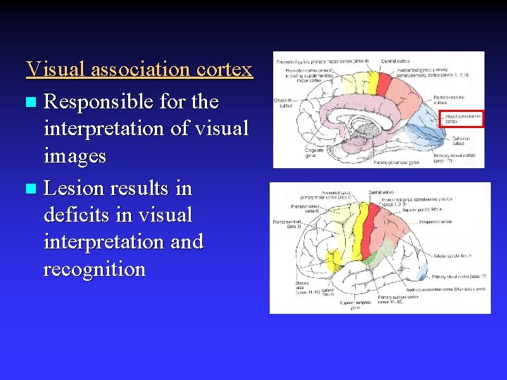 Visual association cortex n Responsible for the interpretation of visual images n Lesion results