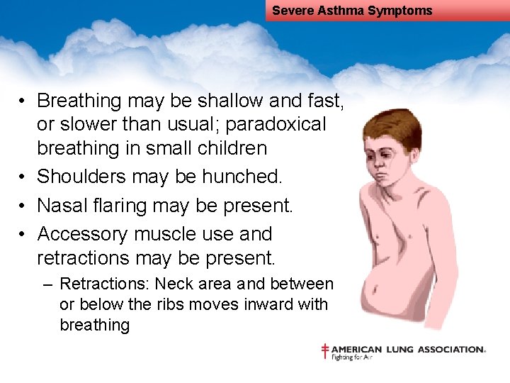 Severe Asthma Symptoms • Breathing may be shallow and fast, or slower than usual;
