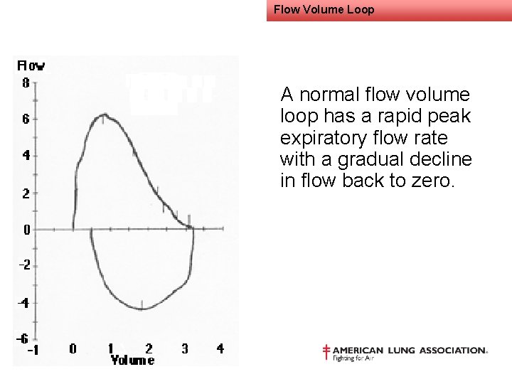 Flow Volume Loop A normal flow volume loop has a rapid peak expiratory flow