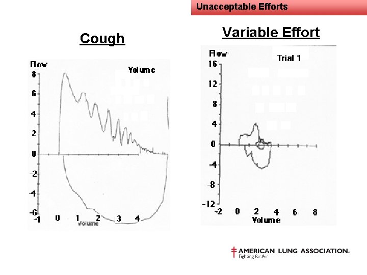 Unacceptable Efforts Cough Variable Effort 