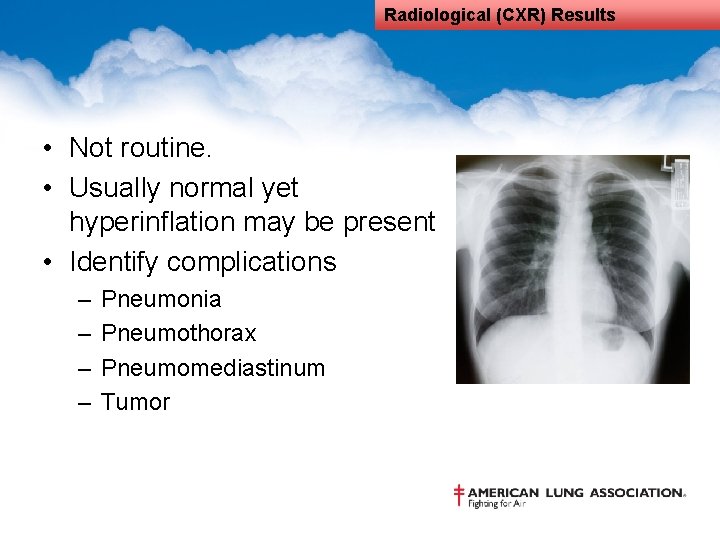 Radiological (CXR) Results • Not routine. • Usually normal yet hyperinflation may be present