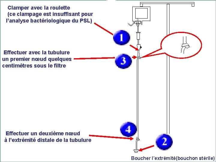  Clamper avec la roulette (ce clampage est insuffisant pour l’analyse bactériologique du PSL)