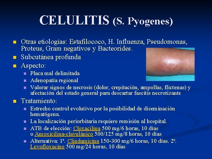 CELULITIS (S. Pyogenes) n n n Otras etiologías: Estafilococo, H. Influenza, Pseudomonas, Proteus, Gram