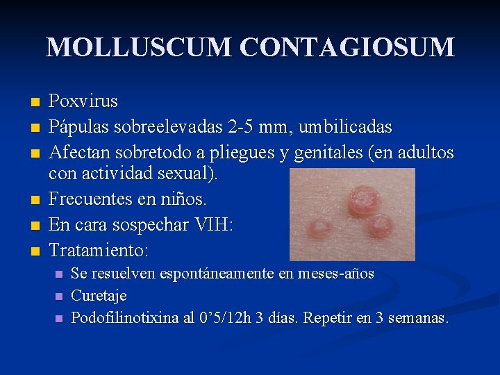 MOLLUSCUM CONTAGIOSUM n n n Poxvirus Pápulas sobreelevadas 2 -5 mm, umbilicadas Afectan sobretodo