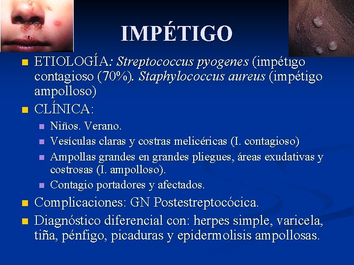 IMPÉTIGO n n ETIOLOGÍA: Streptococcus pyogenes (impétigo contagioso (70%). Staphylococcus aureus (impétigo ampolloso) CLÍNICA: