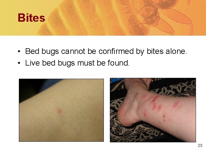 Bites • Bed bugs cannot be confirmed by bites alone. • Live bed bugs