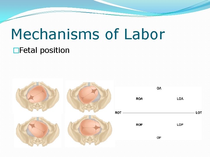 Mechanisms of Labor �Fetal position 