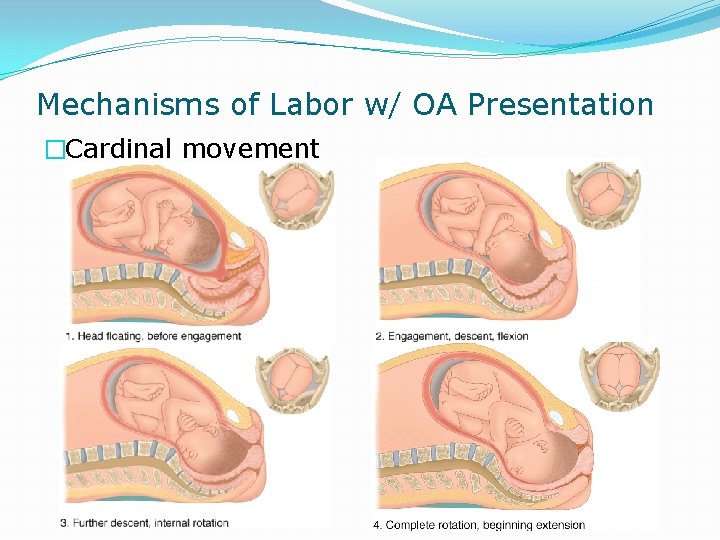 Mechanisms of Labor w/ OA Presentation �Cardinal movement 