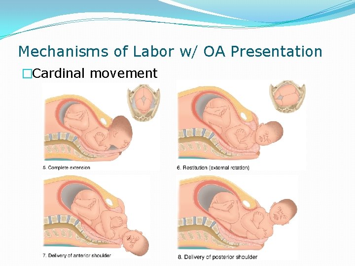 Mechanisms of Labor w/ OA Presentation �Cardinal movement 