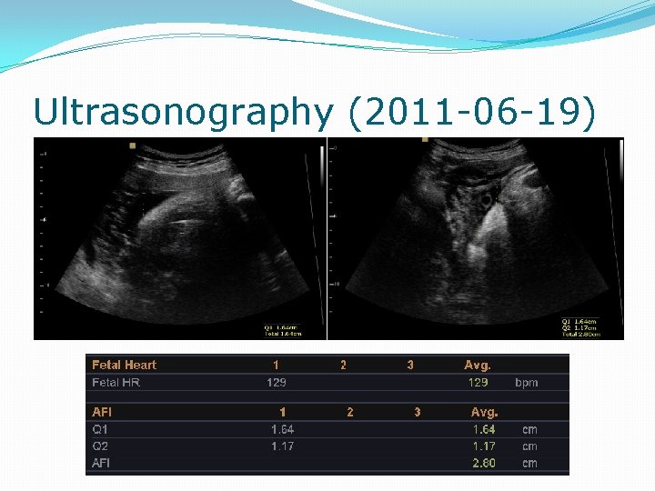 Ultrasonography (2011 -06 -19) 