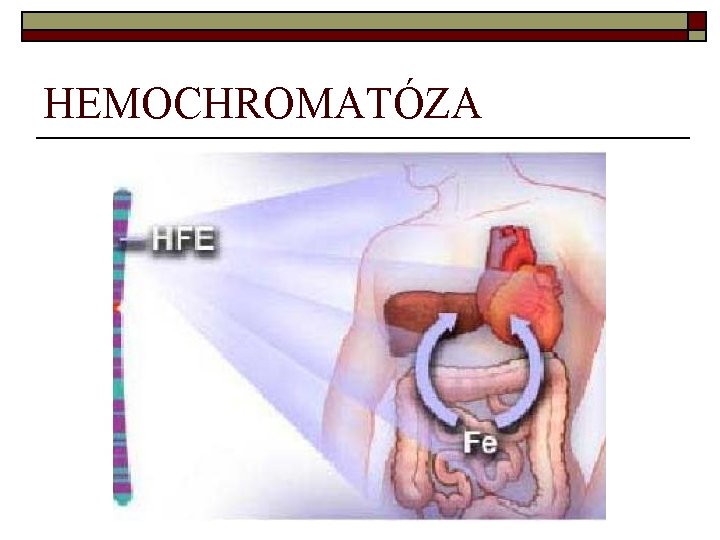 HEMOCHROMATÓZA 