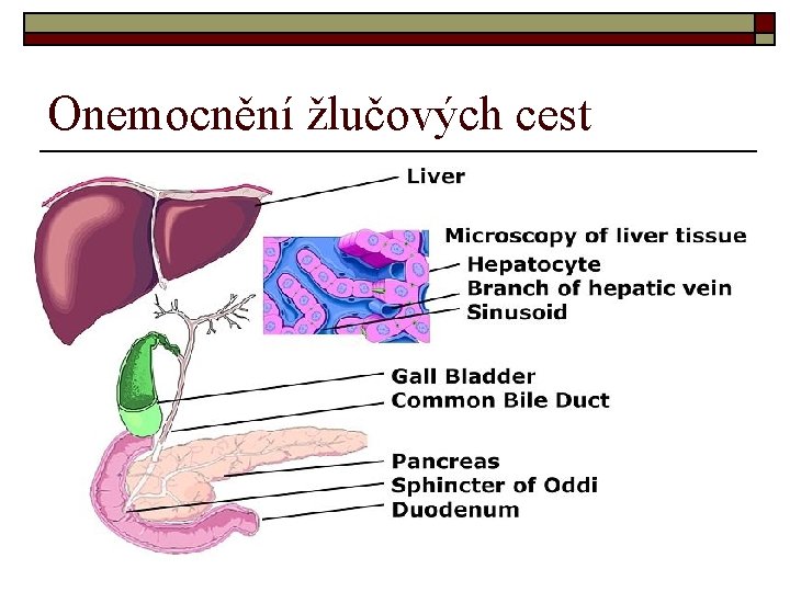 Onemocnění žlučových cest 