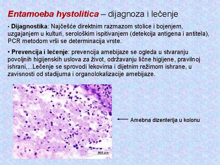 Entamoeba hystolitica – dijagnoza i lečenje • Dijagnostika: Najčešće direktnim razmazom stolice i bojenjem,