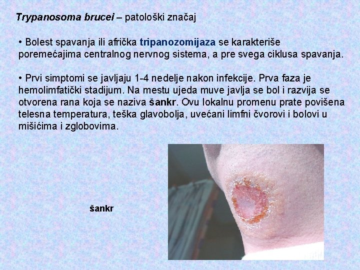 Trypanosoma brucei – patološki značaj • Bolest spavanja ili afrička tripanozomijaza se karakteriše poremećajima