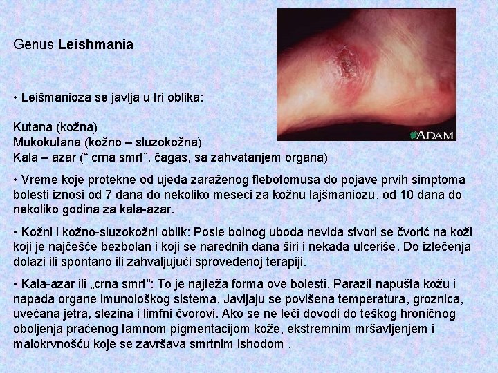 Genus Leishmania • Leišmanioza se javlja u tri oblika: Kutana (kožna) Mukokutana (kožno –