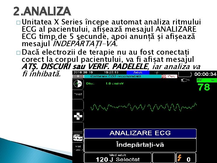 2. ANALIZA � Unitatea X Series începe automat analiza ritmului ECG al pacientului, afișează