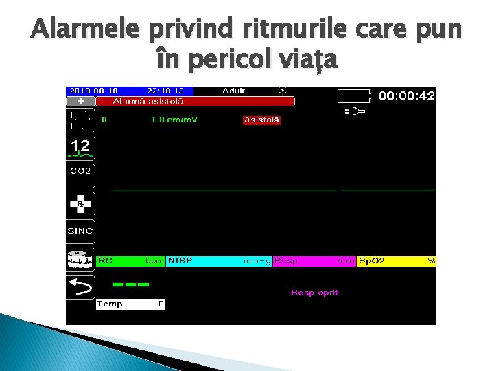 Alarmele privind ritmurile care pun în pericol viața 