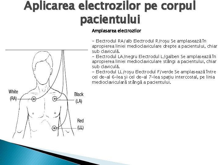 Aplicarea electrozilor pe corpul pacientului Amplasarea electrozilor - Electrodul RA/alb Electrodul R/roșu Se amplasează