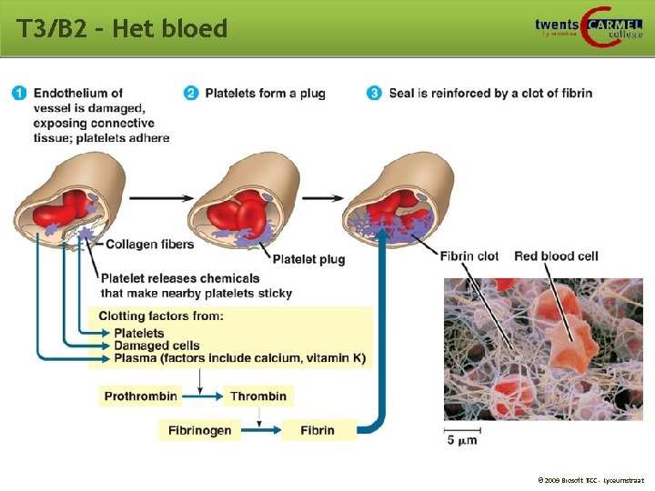 T 3/B 2 – Het bloed © 2009 Biosoft TCC - Lyceumstraat 