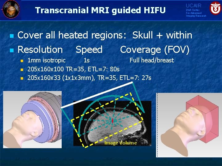 Transcranial MRI guided HIFU n n UCAIR Utah Center For Advanced Imaging Research Cover