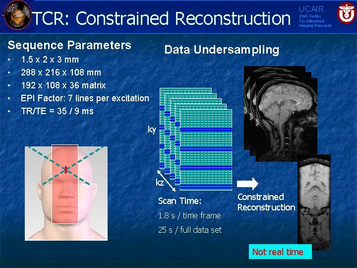 TCR: Constrained Reconstruction Sequence Parameters • • • UCAIR Utah Center For Advanced Imaging