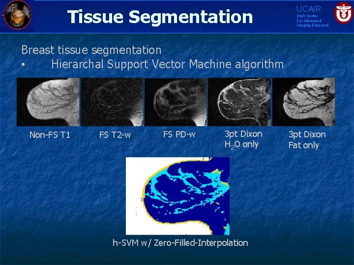 Tissue Segmentation UCAIR Utah Center For Advanced Imaging Research Breast tissue segmentation • Hierarchal