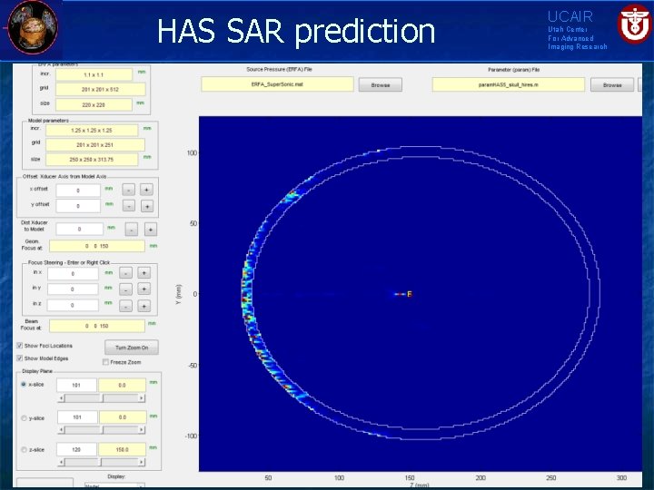 HAS SAR prediction UCAIR Utah Center For Advanced Imaging Research 