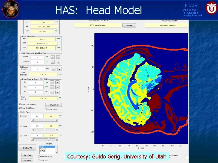 HAS: Head Model Courtesy: Guido Gerig, University of Utah UCAIR Utah Center For Advanced