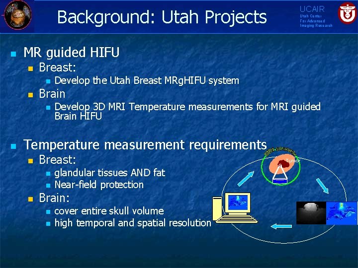 Background: Utah Projects n Utah Center For Advanced Imaging Research MR guided HIFU n