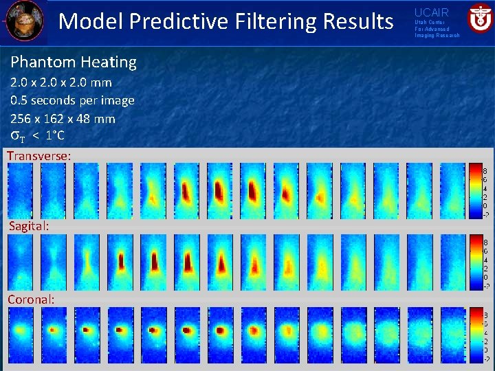 Model Predictive Filtering Results Phantom Heating 2. 0 x 2. 0 mm 0. 5