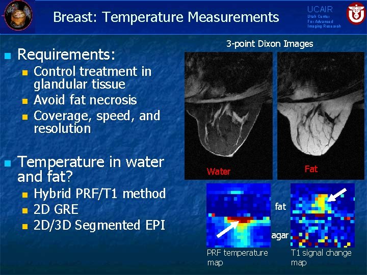 Breast: Temperature Measurements n Requirements: n n n Utah Center For Advanced Imaging Research