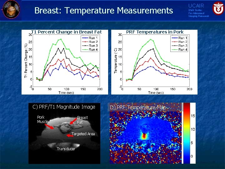 Breast: Temperature Measurements T 1 Percent Change in Breast Fat PRF Temperatures in Pork