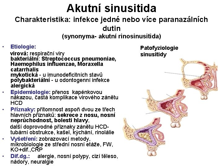 Akutní sinusitida Charakteristika: infekce jedné nebo více paranazálních dutin (synonyma- akutní rinosinusitida) • •