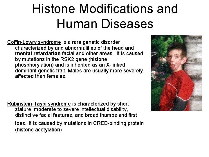 Histone Modifications and Human Diseases Coffin-Lowry syndrome is a rare genetic disorder characterized by