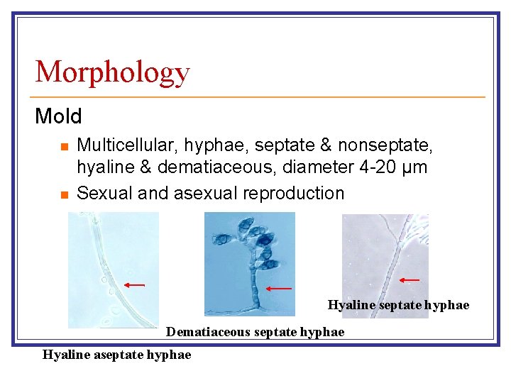 Morphology Mold n n Multicellular, hyphae, septate & nonseptate, hyaline & dematiaceous, diameter 4