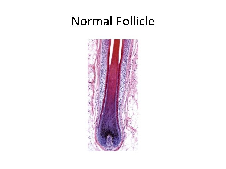 Normal Follicle 