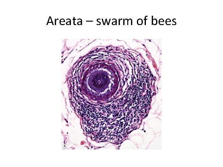 Areata – swarm of bees 