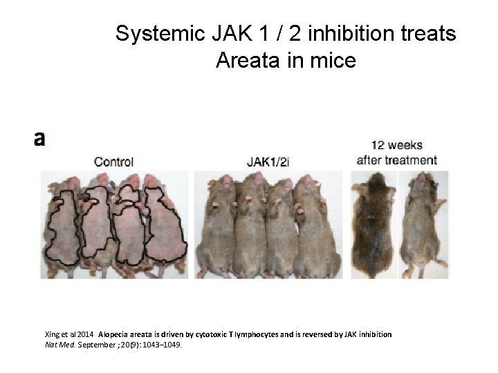 Systemic JAK 1 / 2 inhibition treats Areata in mice Xing et al 2014