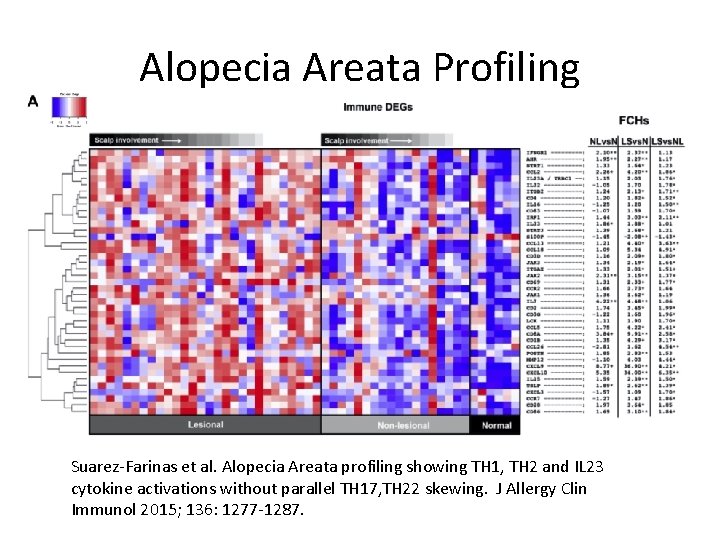 Alopecia Areata Profiling • Molecular profiling comparing of lesion and non-lesional biopsy specimens •