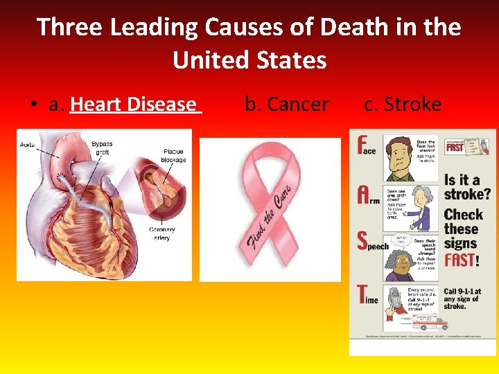 Three Leading Causes of Death in the United States • a. Heart Disease b.