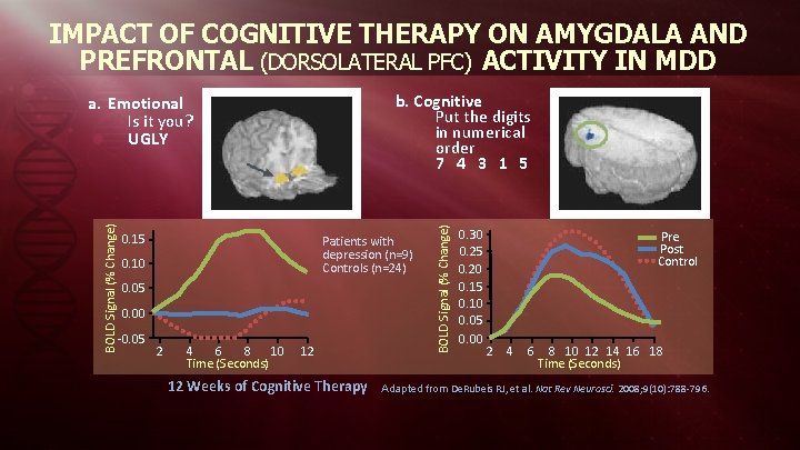 IMPACT OF COGNITIVE THERAPY ON AMYGDALA AND PREFRONTAL (DORSOLATERAL PFC) ACTIVITY IN MDD BOLD