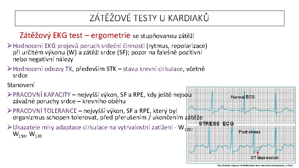 ZÁTĚŽOVÉ TESTY U KARDIAKŮ Zátěžový EKG test – ergometrie se stupňovanou zátěží ØHodnocení EKG