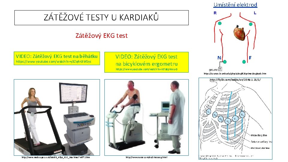 Umístění elektrod ZÁTĚŽOVÉ TESTY U KARDIAKŮ Zátěžový EKG test VIDEO: Zátěžový EKG test na